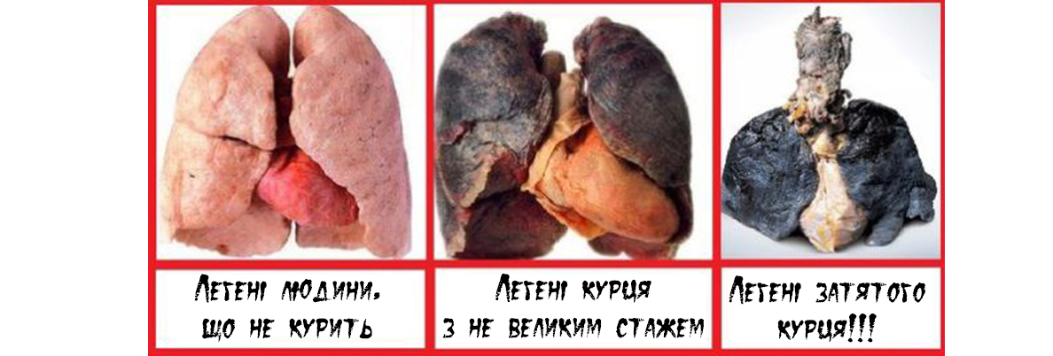  Як кинути палити?